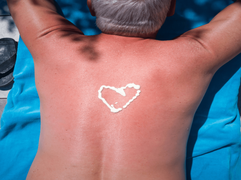 Person liegt auf dem Bauch, auf dem Rücken Sonnenbrand und ein Herz aus Sonnenmilch.