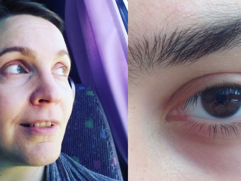 Eine Frau mit Augenschatten und ein rangezoomtes Auge mit Augenringen