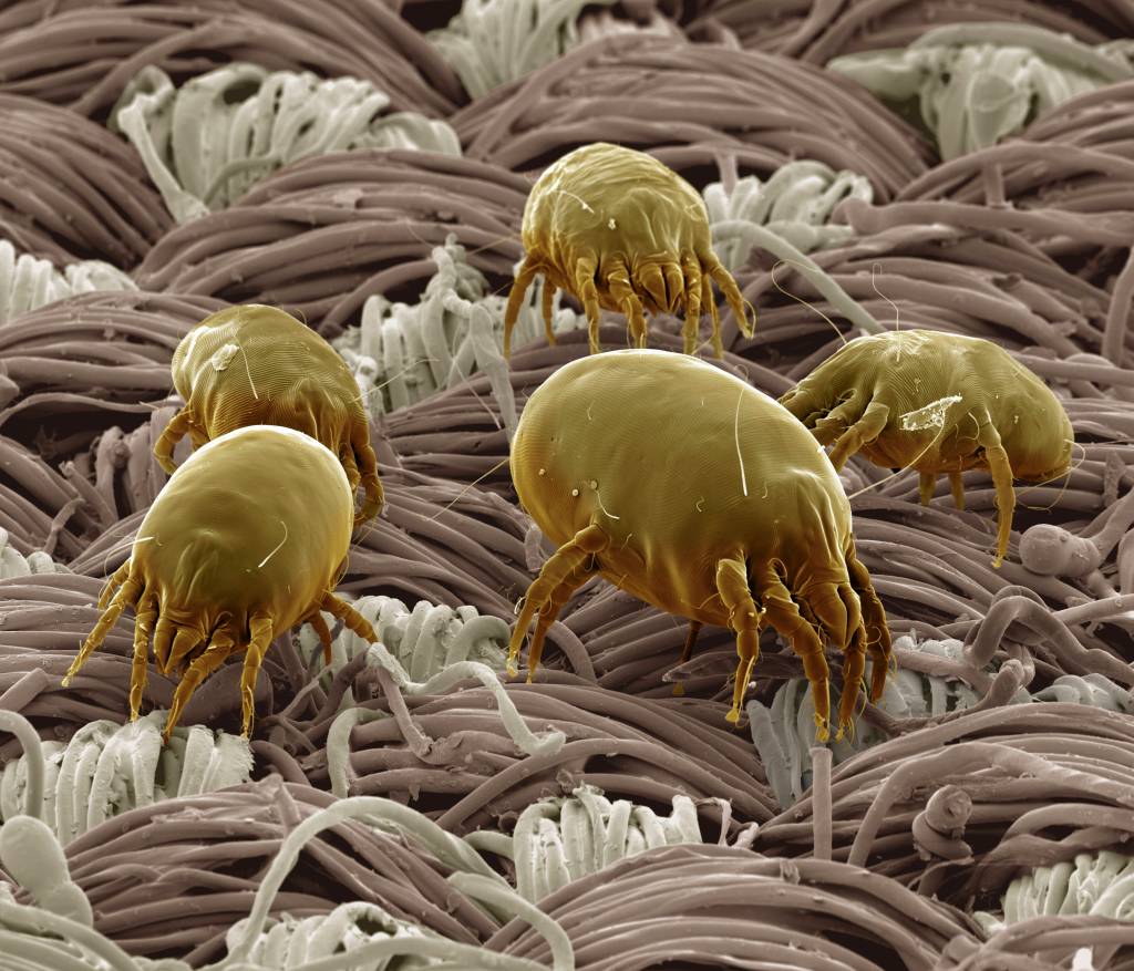 Milben in mikroskopischer Aufnahme