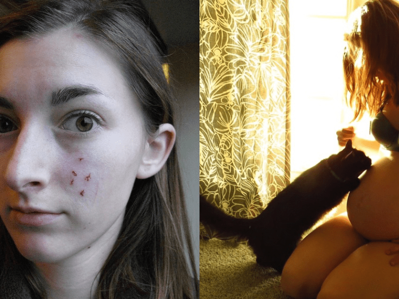 Bild links: Frau mit Kratzspuren im Gesicht. Bild rechts: Schwangere Frau mit Katze.