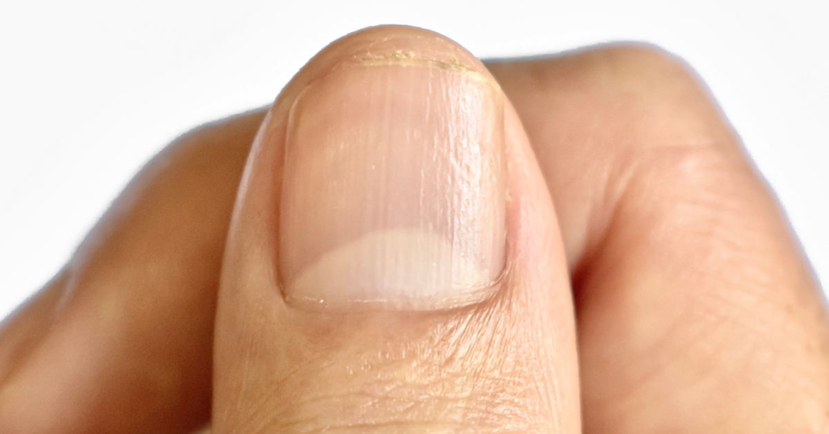 Ein Fingernagel, bei dem die Lunula gut ausgeprägt ist. Der weiße Halbmond gibt Ausschluss über die Gesundheit.