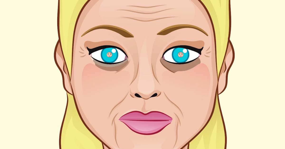Frontalbild-Zeichnung, die den Kopf einer erschÃ¶pften Frau mit weit geÃ¶ffneten Augen und Sorgenfalten im Gesicht zeigt.