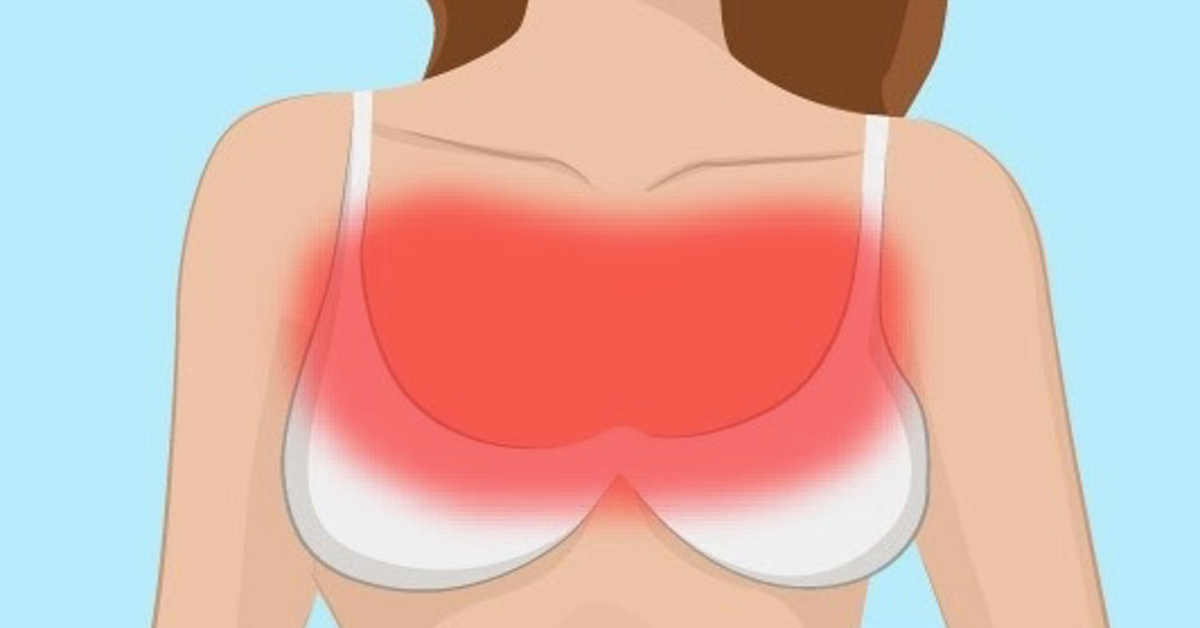 Symbolbild des Brustbereichs einer Frau. Rot eingefÃ¤rbt ist der Bereich, der wegen eines zu kleinen BHs Schmerzen verursachen kann.