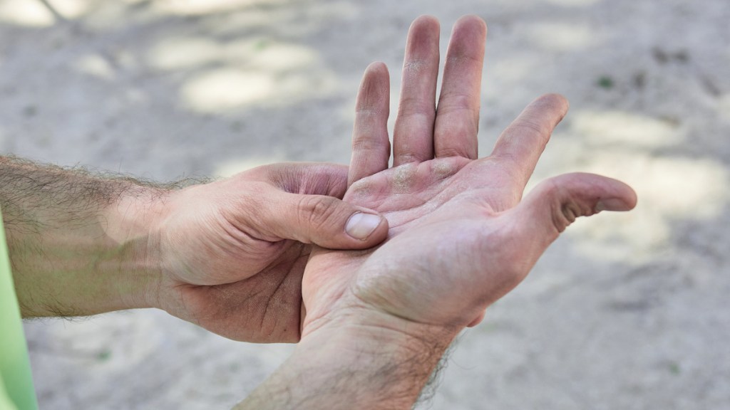 Ein Mann hält seine Handfläche fest, so als schmerze sie.