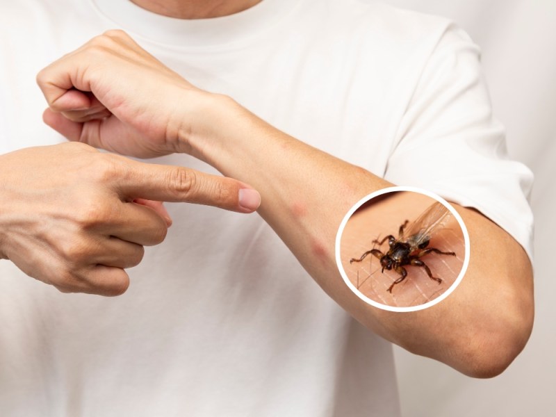Ein Bild einer Hirschlausfliege in Vergrößerung und ein Mann mit weißem T-Shirt und Insektenstichen auf dem Arm.