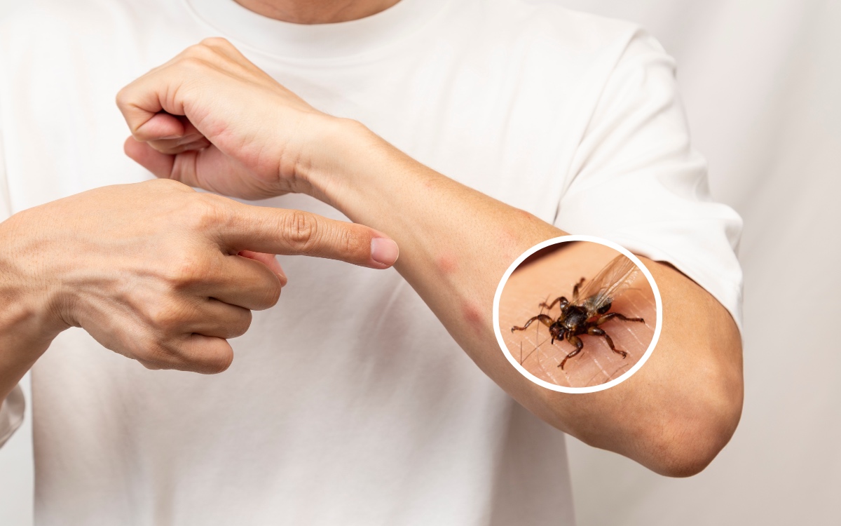 Ein Bild einer Hirschlausfliege in Vergrößerung und ein Mann mit weißem T-Shirt und Insektenstichen auf dem Arm.