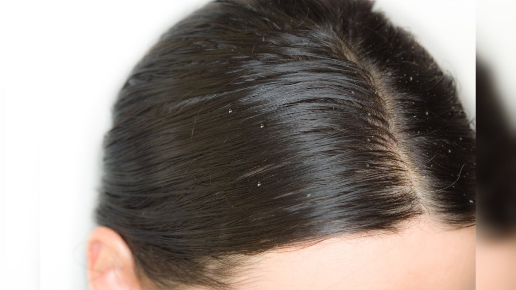 2. Fettige Haare
